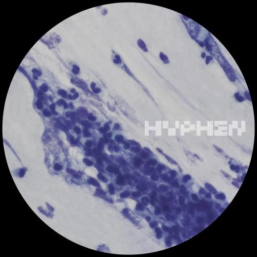 Vauna - Wetlands